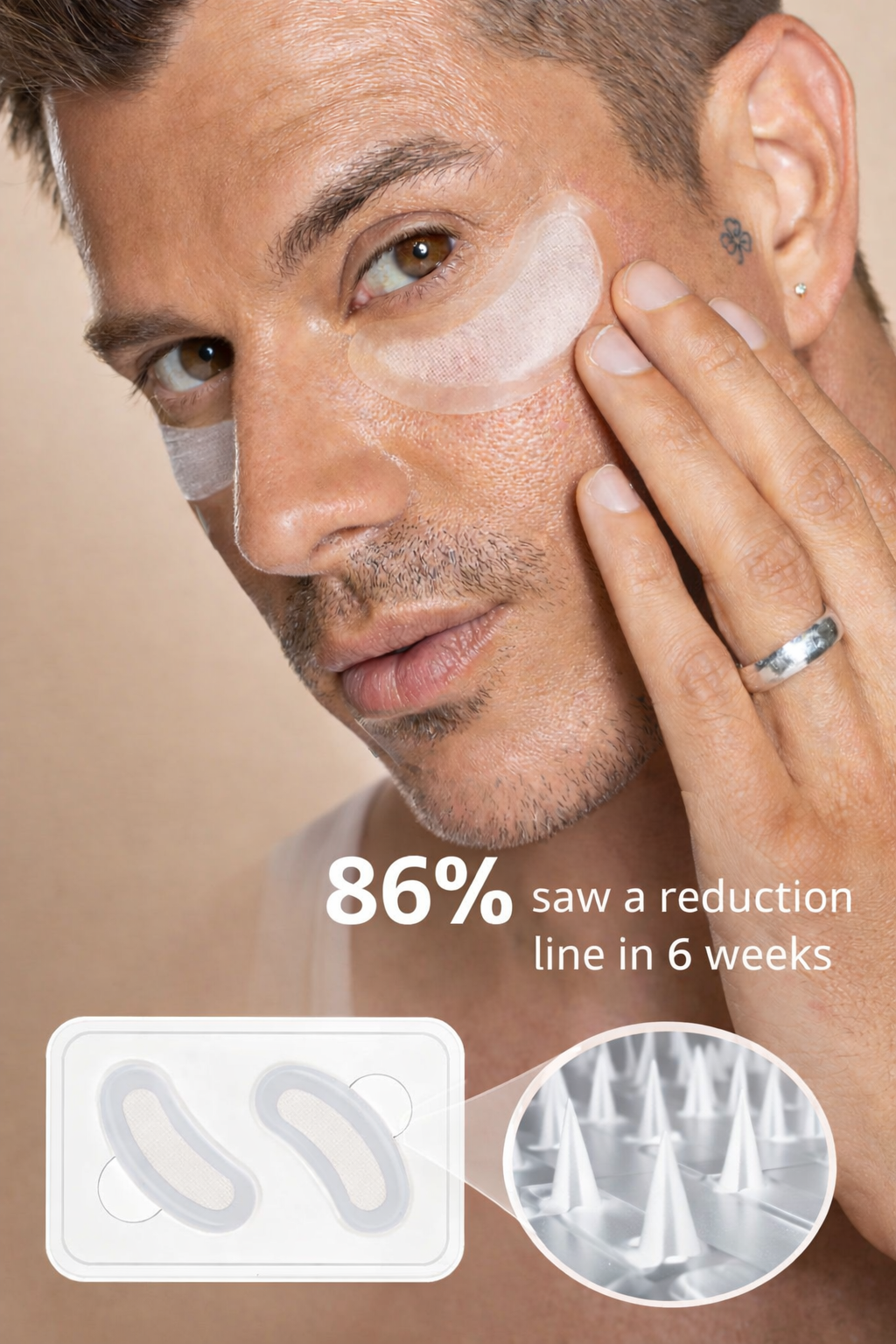Glossiq™ Microneedle Eye Patches